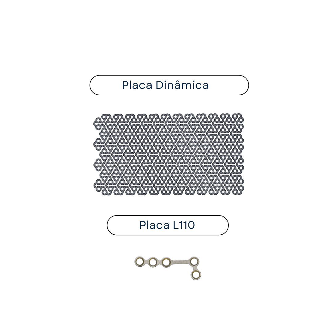 POSTS DE PRODUTOS (10)